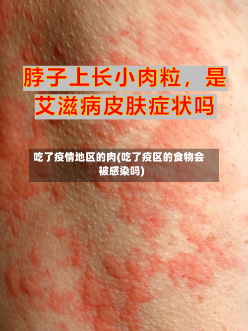 吃了疫情地区的肉(吃了疫区的食物会被感染吗)