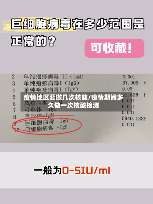 疫情地区要做几次核酸/疫情期间多久做一次核酸检测