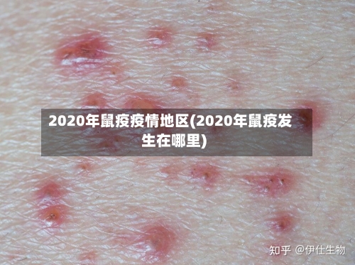 2020年鼠疫疫情地区(2020年鼠疫发生在哪里)